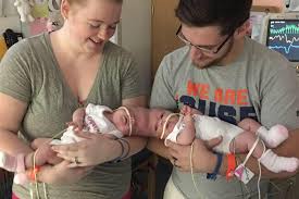 Bit.ly/2ol5mam the amazing abby and brittany hensel are in their final year of college and. Mom Of Recently Separated Conjoined Twins This Is Only The Beginning