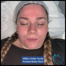 All the steps to the...