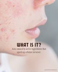 CHICAGO SUBURBS AESTHETICIAN