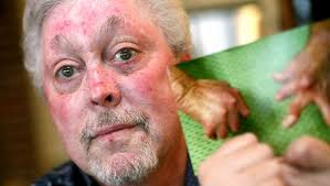 Edmond family touched by injured man's hand transplant experience