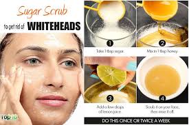 Home Remedies For Whiteheads Top 10 Home Remedies Exfoliating Face Scrub Whiteheads Homemade Face Masks
