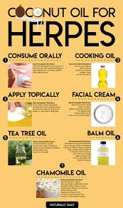 Pin On Natural Home Remedies