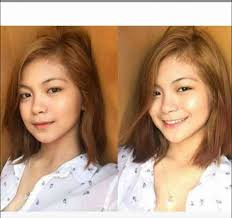 any idea sino po ang doctor nya? Siobe Lim Gf ni Nik Makino thankyou