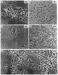 But looking for culture add helps managers to determine how a candidate's individuality and differences can make a company better and stronger. Morphological Cycle Of Strain P Ll An Endospore Containing Culture Was Download Scientific Diagram