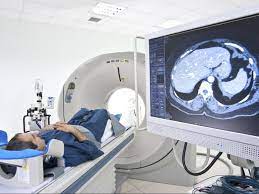 Apa yang dimaksud dengan ct scan, yang rekomendasi harus diamati sebelum prosedur, selama dan setelah itu. Hasilkan Paparan Radiasi Ct Scan Ditengarai Bisa Sebabkan Kerusakan Dna