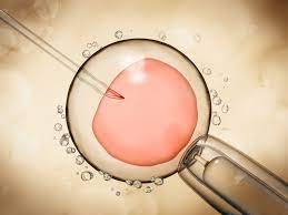 Ivf Und Icsi Was Eine Kunstliche Befruchtung Kostet