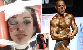Hull mother left with horrific injuries after being assaulted by body  builder