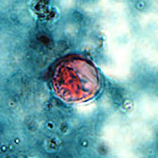 Image result for Cyclospora