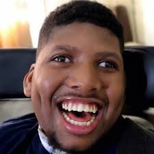 All of these children were born completely normal, but then someone shook  them violently as toddlers, which resulted in developing what is known as  shaken baby syndrome. 😢💔 You can see the