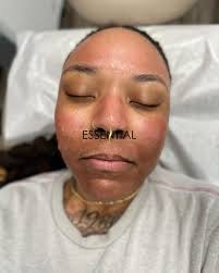 Want smoother firmer skin? ✨Microneedling can help you achieve that. ✨It  works by stimulating collagen and elastin production to achieve improvement  in skin texture, tone, pore size and fine lines. ✨Safe for