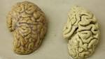  Why the pharmaceutical industry is giving up the search for an Alzheimer's cure