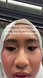 Soothing Eye Care Tips for Contact Lens Wearers