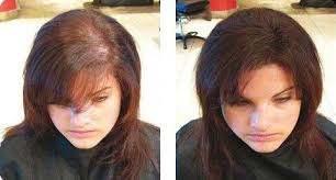 Spray Volumizzante Antidiradamento per capelli fini/sottili uomo e donna