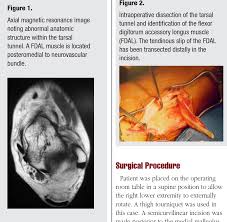 نتیجه جستجوی لغت [accessorius] در گوگل