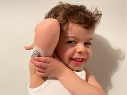 worlddiabetesday #t1d