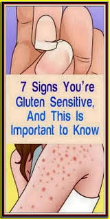 10 Signs You Re Gluten Sensitive And This Is Important To Know Natural Gluten Sensitivity Migraine Headaches Fibromyalgia