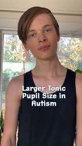 Reposting because a lot of people have been asking lately!😊❤️❤️❤️ Did you  know larger tonic pupil size (dilated pupils) can be a symptom of autism?  It is not widely known, but it