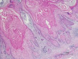 Oopsie_itskuki squirts hard in an amateur webcam show