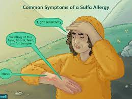 Sulfa Allergy Symptoms Causes Diagnosis And Treatment