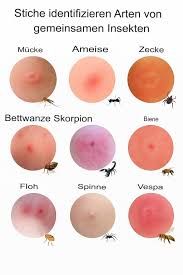 Image result for spinne biss haut reaktion