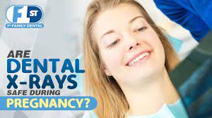 Are Dental X Rays Safe During Pregnancy 1st Family Dental Blog