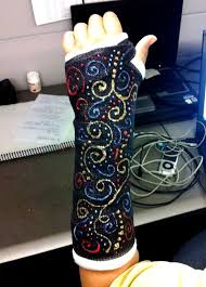 Cast Art Boodoomoo S Blog Cast Decoration Cast Art Leg Cast