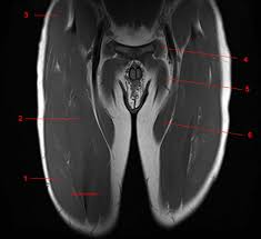 This webpage presents the anatomical structures found on thigh mri. Mri Of The Thigh Detailed Anatomy Superior Part W Radiology