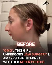 📎: https://amomama.co/3GZTuYd "This is so beautiful."😭