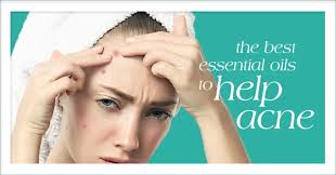 What Are The Top 5 Best Essential Oil Brands?