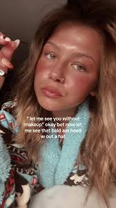 Confidence Without Makeup: Embracing Natural Beauty