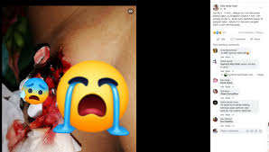 Zakar mungkin bengkok atau terpusing. Alat Sulit Keluar Banyak Gumpalan Darah Beku Terpaksa Jalani Pembedahan Plastik Bawang Rangers