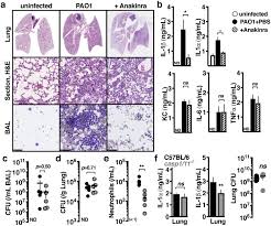 The Pseudomonas Aeruginosa Protease Lasb Directly Activates Il 1b Ebiomedicine