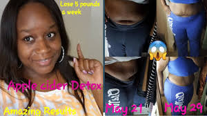 Pin On Health
