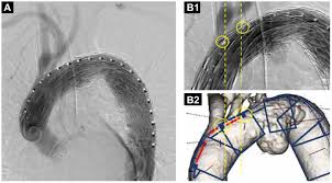 Image result for Jaw Claudication