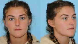 Berlet Plastic Surgery New York| Bookings Closing Soon