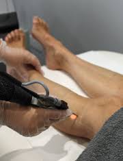 Both women and men can be confident that laser hair removal can give them a safe way to permanently remove unwanted hair. The Complete List Of Laser Hair Removal Contraindications Award Winning Aesthetics Clinic Surrey Sussex Laser Anti Ageing
