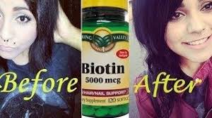 Black Hair Biotin Hair Growth Before And After Pictures Biotin Hair Growth Results Before And After Biotin Hair Growth Biotin Hair Growth Results Biotin Hair Growth Vitamins