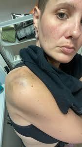 Can seizure medicine affect teeth due to sugar content?