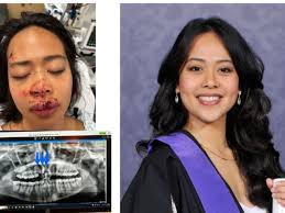 Fundraiser for Angela Fajardo Roxas by Michael Makarchuk : Save Angela's  Smile!