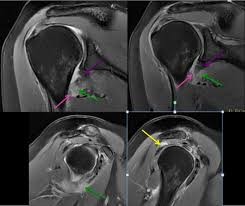 The abbreviation hagl can be used as a polite, but casual way of saying goodbye and wishing someone well if you think there's a chance. Centre D Imagerie Osteo Articulaire Clinique Du Sport De Bordeaux