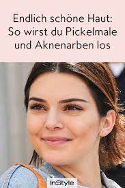 Pickelmale sind aber nicht gleich pickelmale, es wird nämlich zwischen pie (roten pickelmalen) in diesem beitrag erfährst du, was pickelmale eigentlich sind, worauf zu achten ist und wie du sie. Endlich Schone Haut So Wirst Du Pickelmale Und Aknenarben Los Aknenarben Akne Pickel