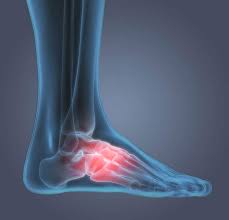 Le pied contient 26 os, 20 muscles, 16 articulations et 107 ligaments: Soulagement Des Douleurs De La Voute Plantaire Dr Scholl S