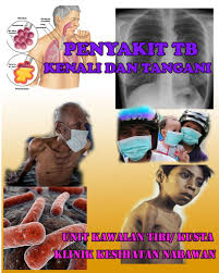 See more of panduan makanan untuk pesakit kencing manis on facebook. Tuberculosis Tibi Kenali Klinik Kesihatan Nabawan Facebook