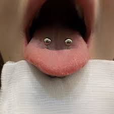 Alberto Netti Body Piercer On Instagram Venom Piercing A 3 Settimane Dall Esecuzione Venom Pie Body Modification Piercings Piercings Double Tongue Piercing
