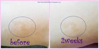 13,028 likes · 20 talking about this. Great Skinandlife Review On Bio Oil