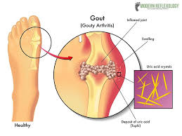 Pin On Acupuncture For Point Goats