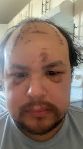 I appreciate the people who ask if I'm okay.