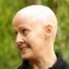 Meet the identical twins who differ in one crucial way