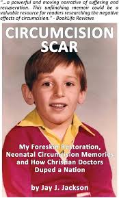 Image result for Neonatal Circumcision