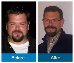 Bariatric & Weight Loss Services